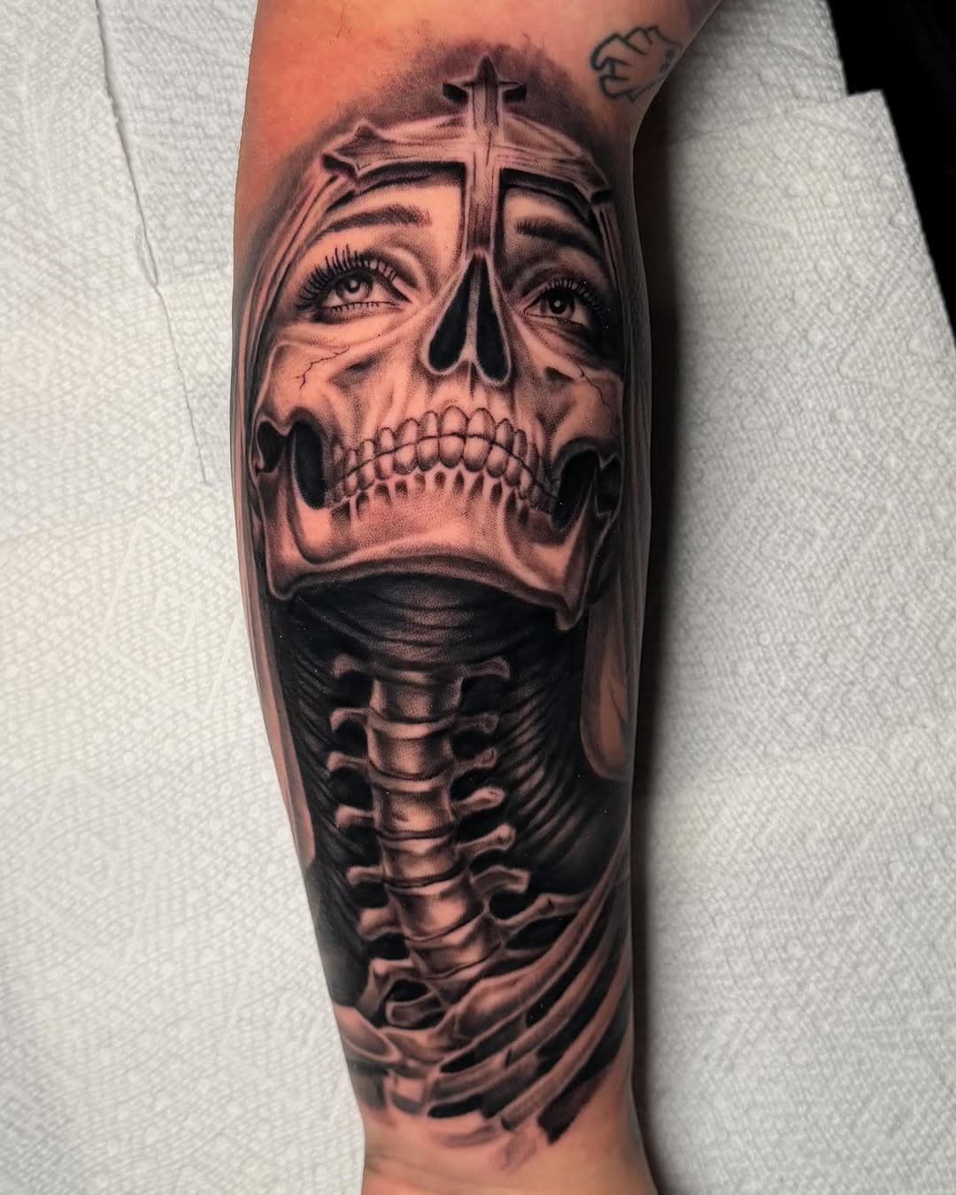 Same forearm, difference sides